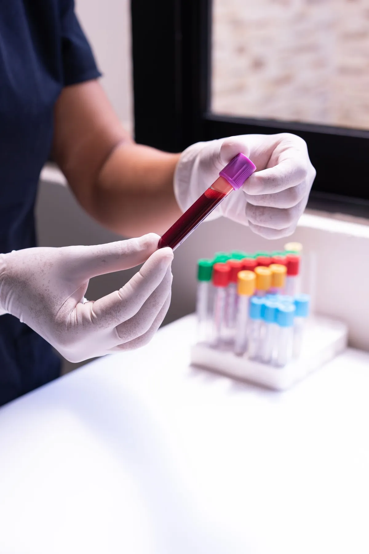 Personal sanitario examinando una muestra de sangre en tubos de ensayo para un análisis de colesterol